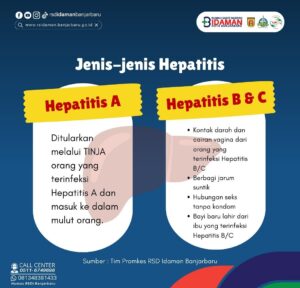 JENIS-JENIS HEPATITIS, RSDI BANJARBARU BERITAU GEJALA DAN CARA CEGAHNYA
