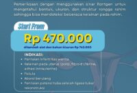 LAYANAN HISTEROSALPINGOGRAFI KINI TERSEDIA DI RSDI BANJARBARU